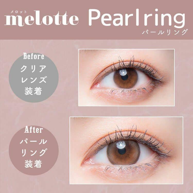 melotte - 1 Day Pearl Ring (10P)